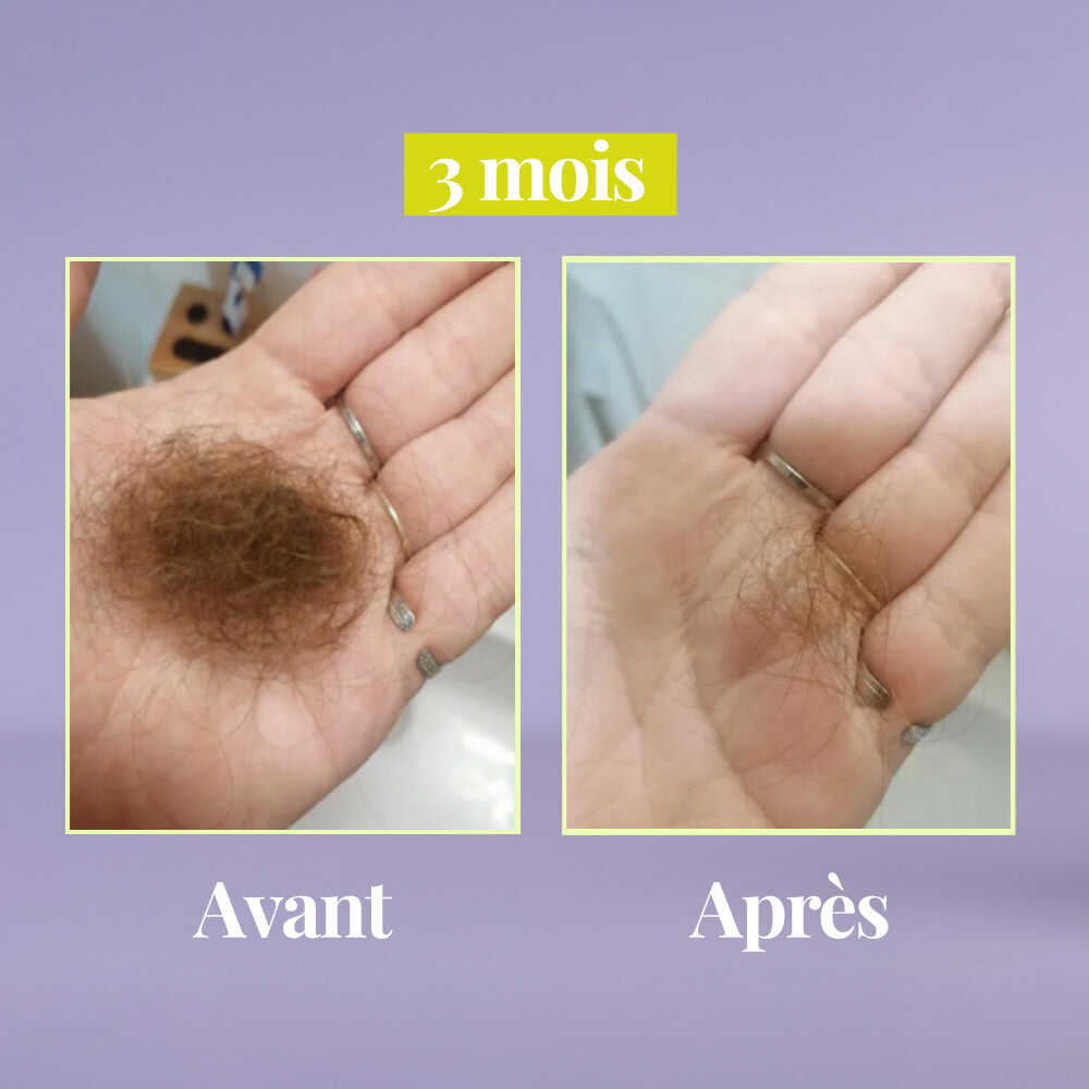 Avant-après 3 mois de cure Les Confiantes montrant l'amélioration visible des cheveux.