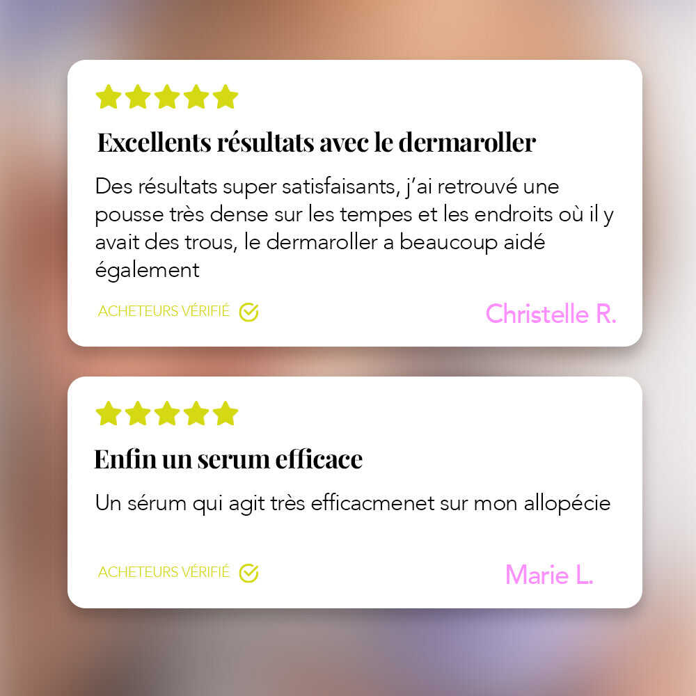 Avis client sur le pack Croissance Intense Les Confiantes avec sérum Dermaroller et Cacao Boost contre l’alopécie, résultats visibles.