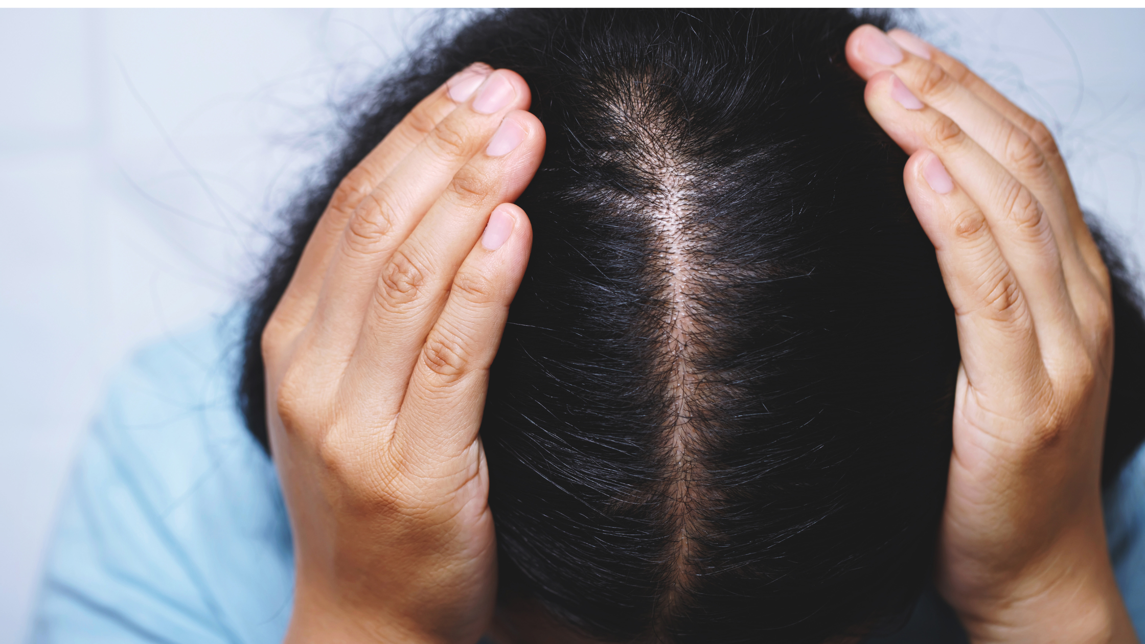 7 Astuces pour Camoufler une Chute de Cheveux