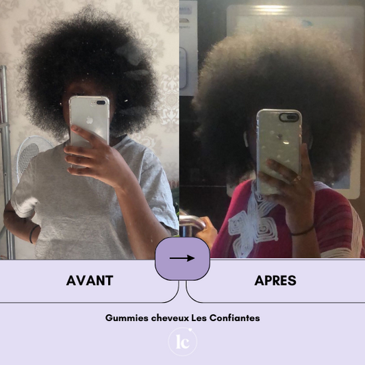 Gummies Cheveux Avant/Après