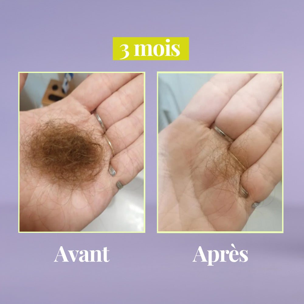 Anti-Hair Loss and Strength Cocoa
