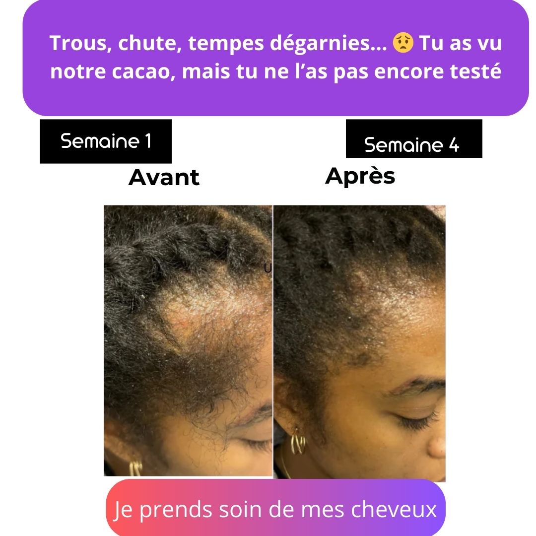 Nos poudres anti-chute cheveux