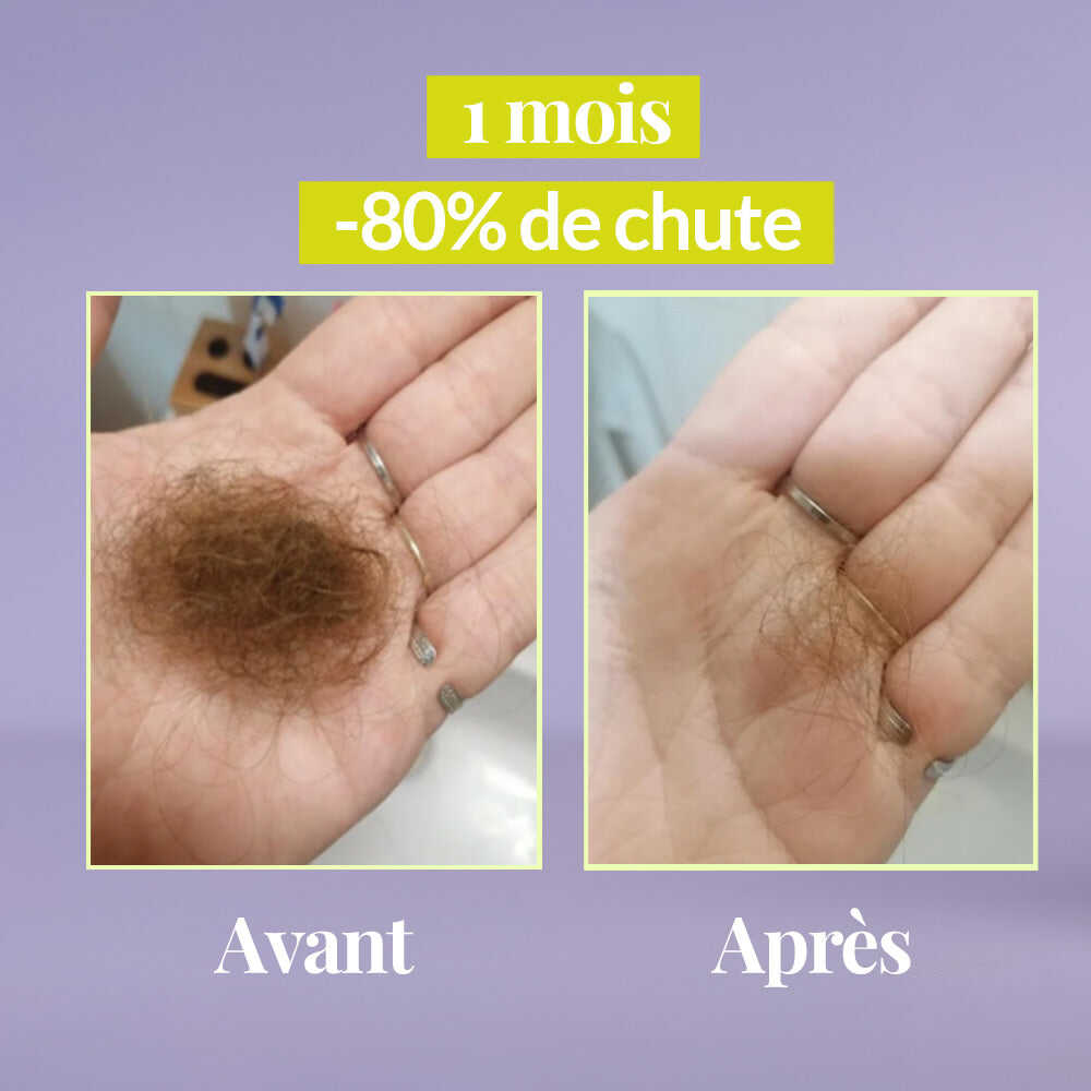 Pack Serum roll-on et Dermaroller Les Confiantes, la routine experte pour booster la pousse des cheveux naturellement.